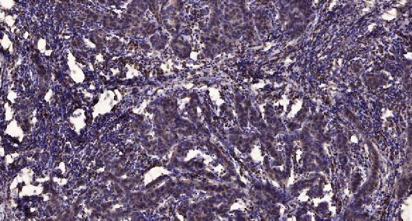 a02095 siah1 primary antibodies ihc testing 1