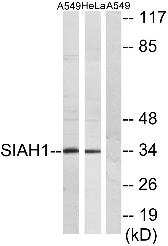 a02095 siah1 primary antibodies wb testing 3