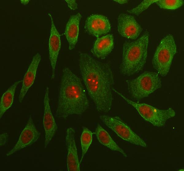 a02096 1 arpc5 primary antibodies if testing 1