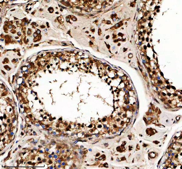 a02096 1 arpc5 primary antibodies ihc testing 1