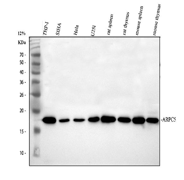 a02096 1 arpc5 primary antibodies wb testing 1