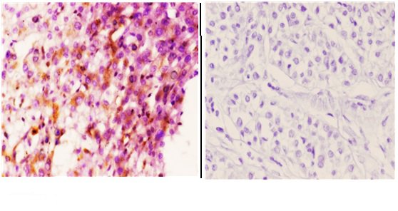a02099 1 pttg1 primary antiboties ihc testing 2