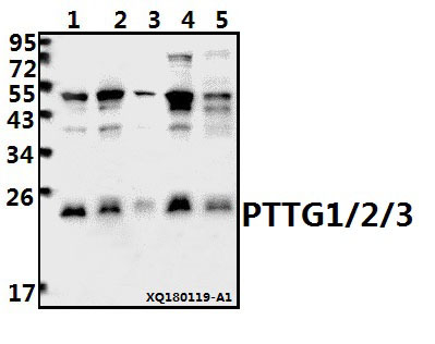 a02099 1 pttg1 primary antiboties wb testing 1