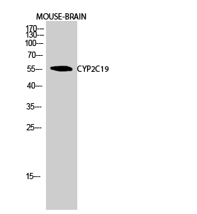 Western Blot analysis of MOUSE-BRAIN cells using CYP2C19 Polyclonal Antibody diluted at 1:1000