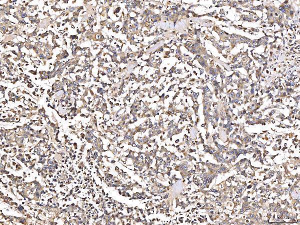 a02103 3 agt primary antibodies ihc testing 2