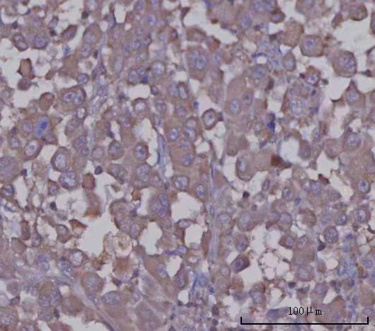a02103 4 agt primary antibodies ihc testing 2