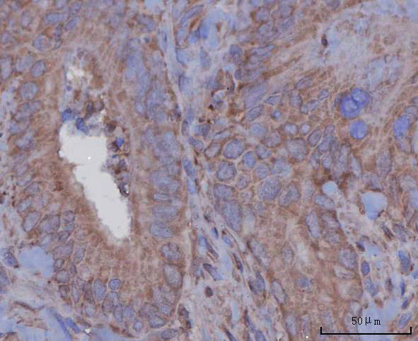a02103 4 agt primary antibodies ihc testing 3