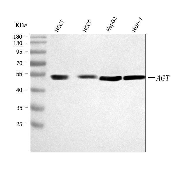 a02103 4 agt primary antibodies wb testing 1