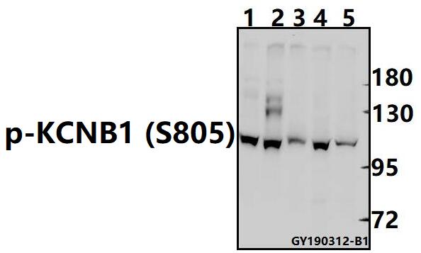a02108s805 kcnb1 primary antiboties wb testing 1