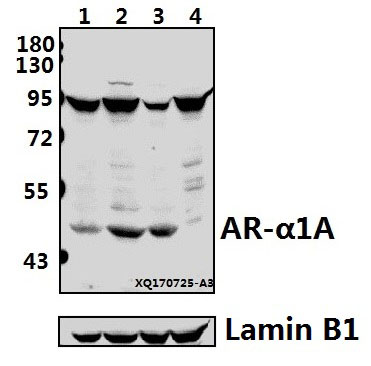 Western blot (WB) analysis of AR-α1A (Q365) pAb at 1:500 dilution
Lane1:HepG2 whole cell lysate(40ug)
Lane2:PC3 whole cell lysate(40ug)
Lane3:LO2 whole cell lysate(40ug)
Lane4:HEK293T whole cell lysate(40ug)