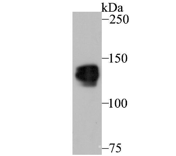 Western blot analysis of Pumilio 1 on SiHa cell using anti-Pumilio 1 antibody at 1/1,000 dilution