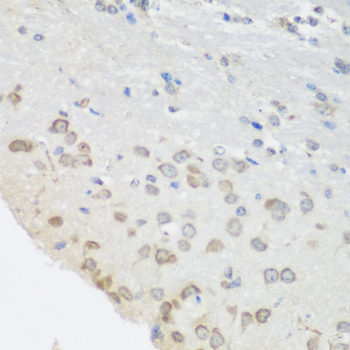 Immunofluorescence analysis of U2OS cells using Pumilio 1 antibody  at dilution of 1:100