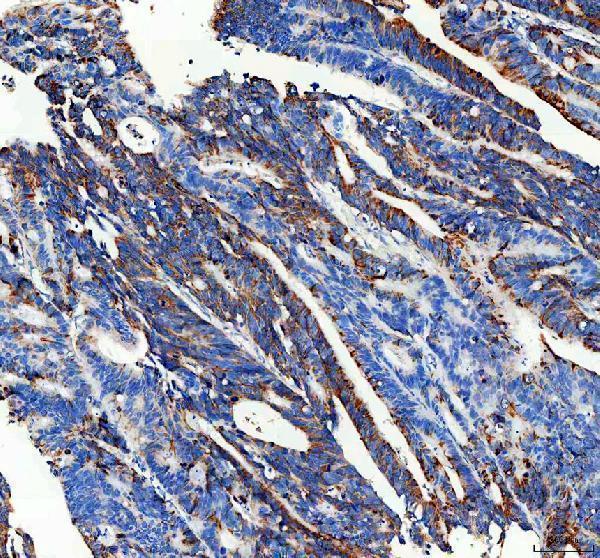 a02112 1 cpt2 primary antibodies ihc testing 1