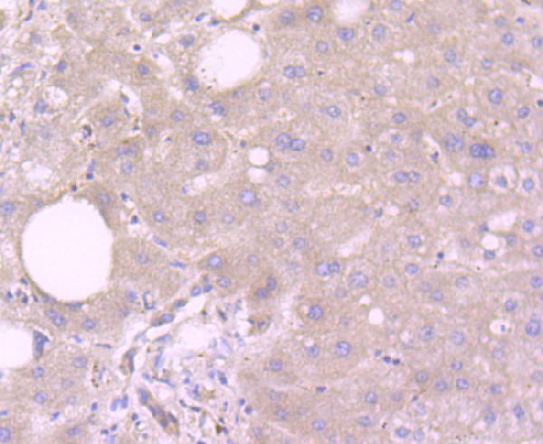 Immunohistochemical analysis of paraffin-embedded human liver tissue using anti-Reelin antibody