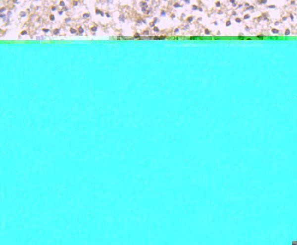 Immunohistochemical analysis of paraffin-embedded human brain tissue using anti-Reelin antibody
