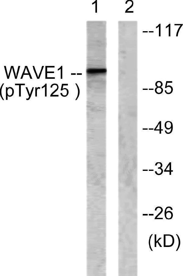 Western blot analysis of lysates from NIH/3T3 cells treated with Insulin 0