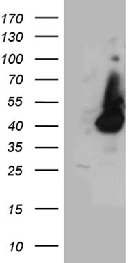 HEK293T cells were transfected with the pCMV6-ENTRY control (Left lane) or pCMV6-ENTRY HPR (Right lane) cDNA for 48 hrs and lysed