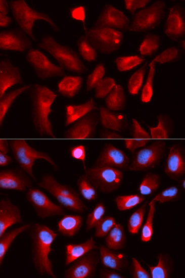 a02116 hif1an primary antiboties if testing 3