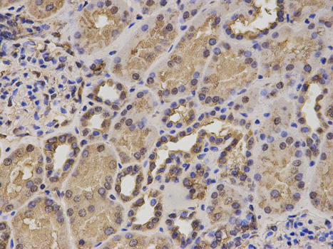 a02116 hif1an primary antiboties wb testing 2