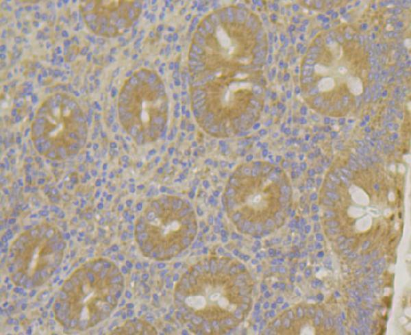 Immunohistochemical analysis of paraffin-embedded human appendix tissue using anti-MARK2 antibody