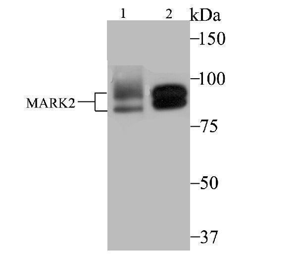 Western blot analysis of MARK2 on MCF-7 (1) and SK-Br-3 (2) cell lysate using anti-MARK2 antibody at 1/2,000 dilution