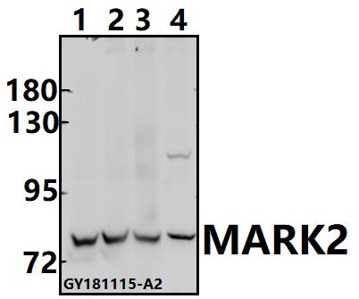 a02117 mark2 primary antiboties wb testing 1