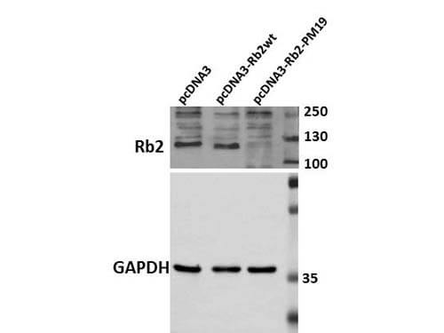 Western Blot of Rabbit Anti-Rb2 p130 Antibody