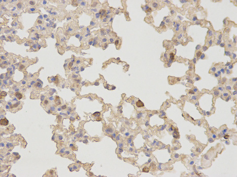 Western blot analysis of extracts of Rat eye, using CD73/NT5E antibody  at 1:1000 dilution