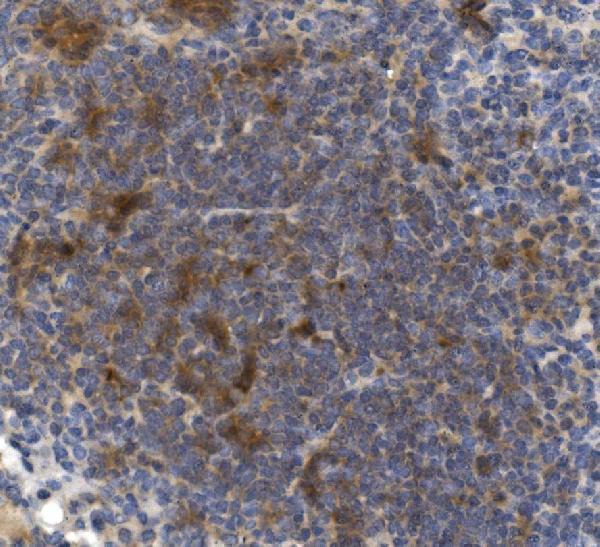  IHC analysis of CD73/Nt5e using anti-CD73/Nt5e antibody (A02120-2)
