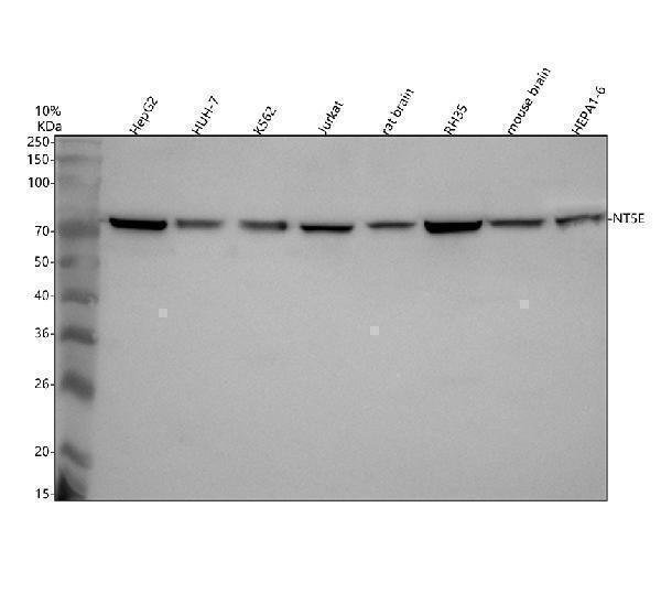  Western blot analysis of CD73/NT5E using anti-CD73/NT5E antibody (A02120-3)