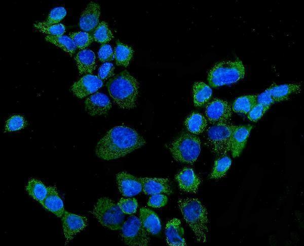 a02121 2 cyp27a1 primary antibodies if testing 1