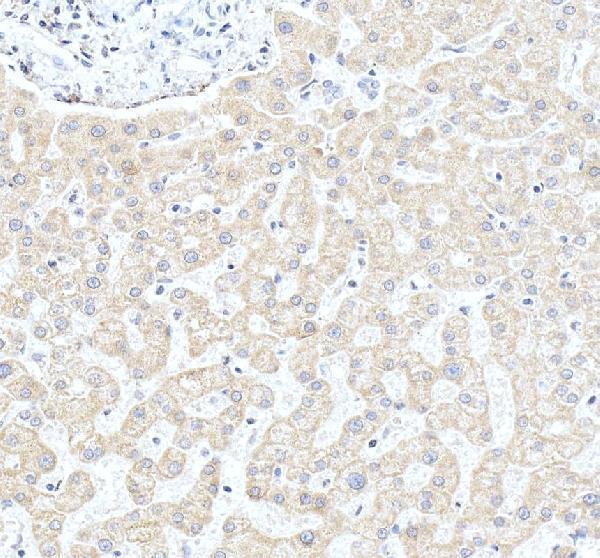 a02121 2 cyp27a1 primary antibodies ihc testing 1
