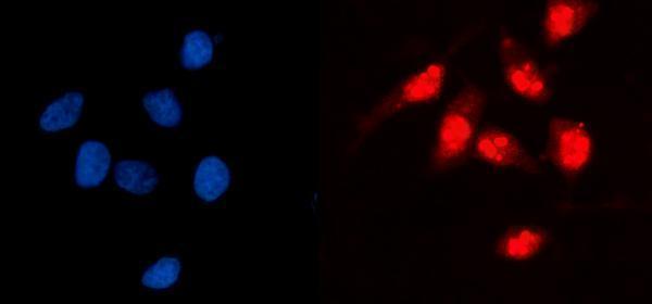  IF analysis of GCKR using anti-GCKR antibody (A02122-2)