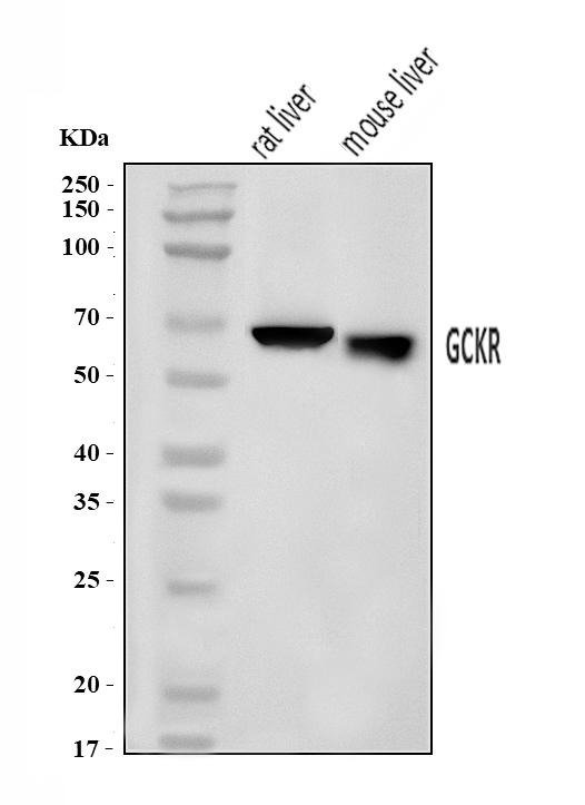  Western blot analysis of GCKR using anti-GCKR antibody (A02122-2)