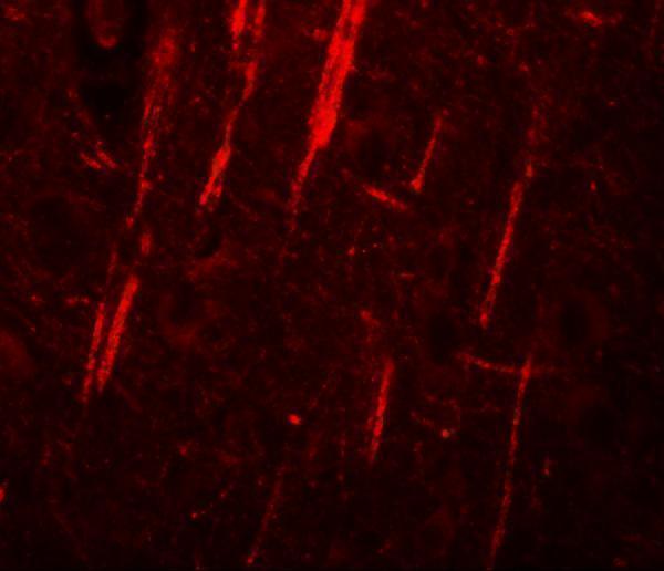 Immunofluorescence of NALP12 in human brain tissue with NALP12 antibody at 20 μg/mL