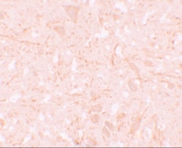 Immunohistochemistry of NALP12 in human brain tissue with NALP12 antibody at 5 μg/mL