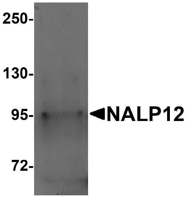 Western blot analysis of NALP12 in human brain tissue lysate with NALP12 antibody at 1 μg/mL