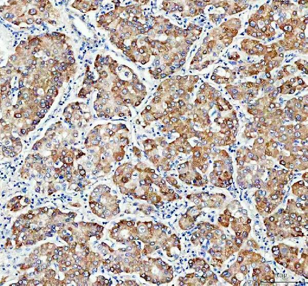  IHC analysis of DHCR24 using anti-DHCR24 antibody (A02125-1)