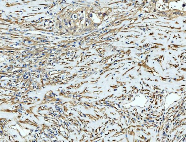  IHC analysis of FHL2 using anti-FHL2 antibody (A02129-2)