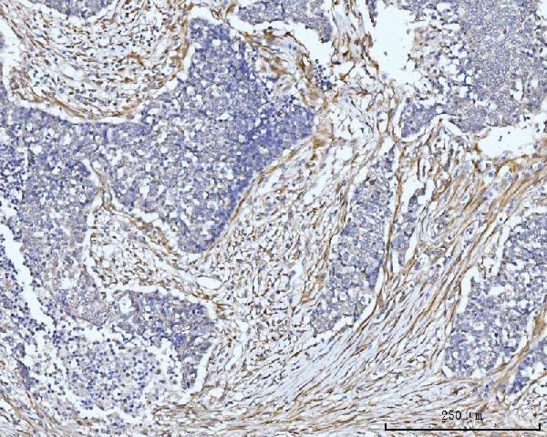  IHC analysis of FHL2 using anti-FHL2 antibody (A02129-2)