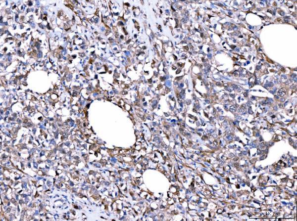 a02129 2 fhl2 primary antibodies ihc testing 5