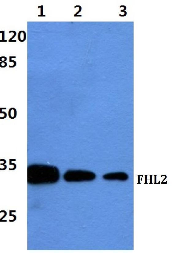 Western blot (WB) analysis of FHL2 polyclonal antibody at 1:500 dilution
Lane1:Hela cell lysate
Lane2:sp2/0 cell lysate
Lane3:H9C2 cell lysate