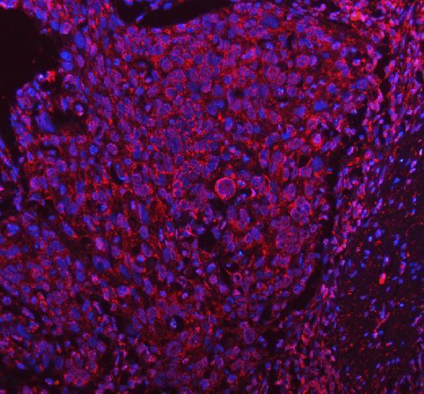 a02132 1 pdk4 primary antibodies if testing 4