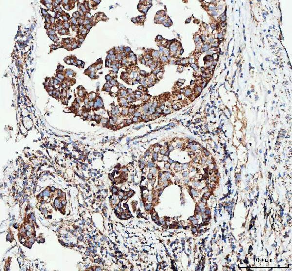  IHC analysis of PDK4 using anti-PDK4 antibody (A02132-1)