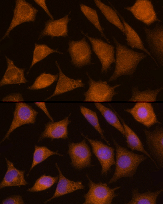 Immunofluorescence analysis of L929 using CTSC antibody  at dilution of 1:100 