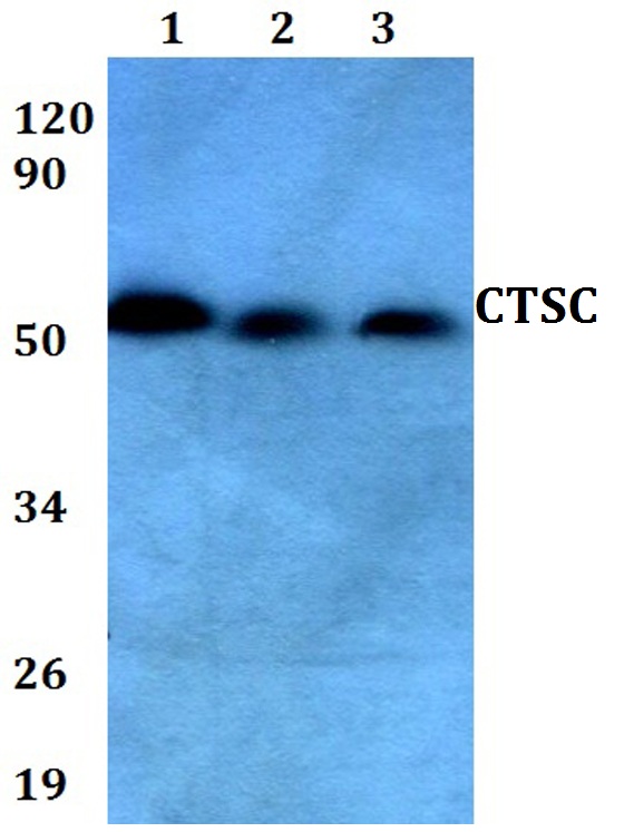 a02136 ctsc primary antiboties wb testing 1