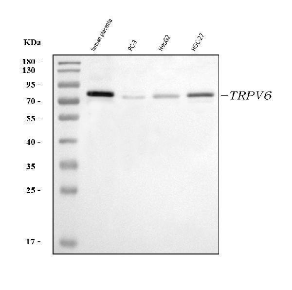  Western blot analysis of TRPV6 using anti-TRPV6 antibody (A02139-2)