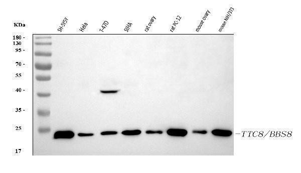  Western blot analysis of BBS8/TTC8 using anti-BBS8/TTC8 antibody (A07486-2)