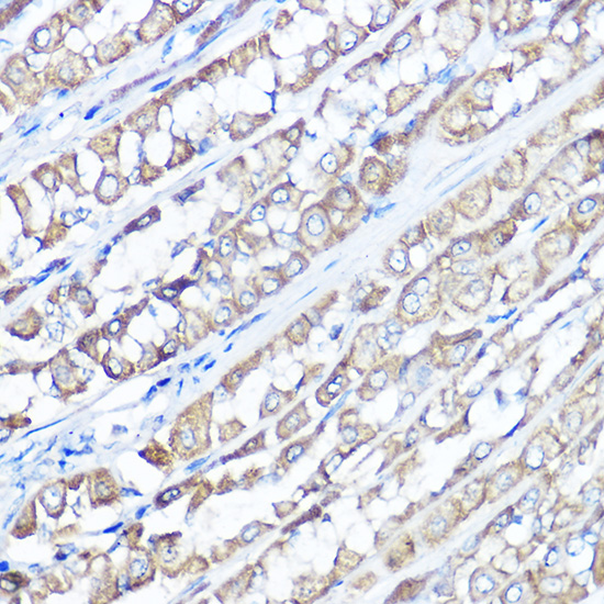 a02139 trpv6 primary antiboties ihc testing 2