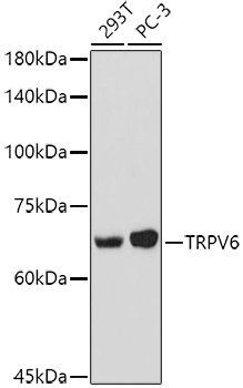 a02139 trpv6 primary antiboties wb testing 1